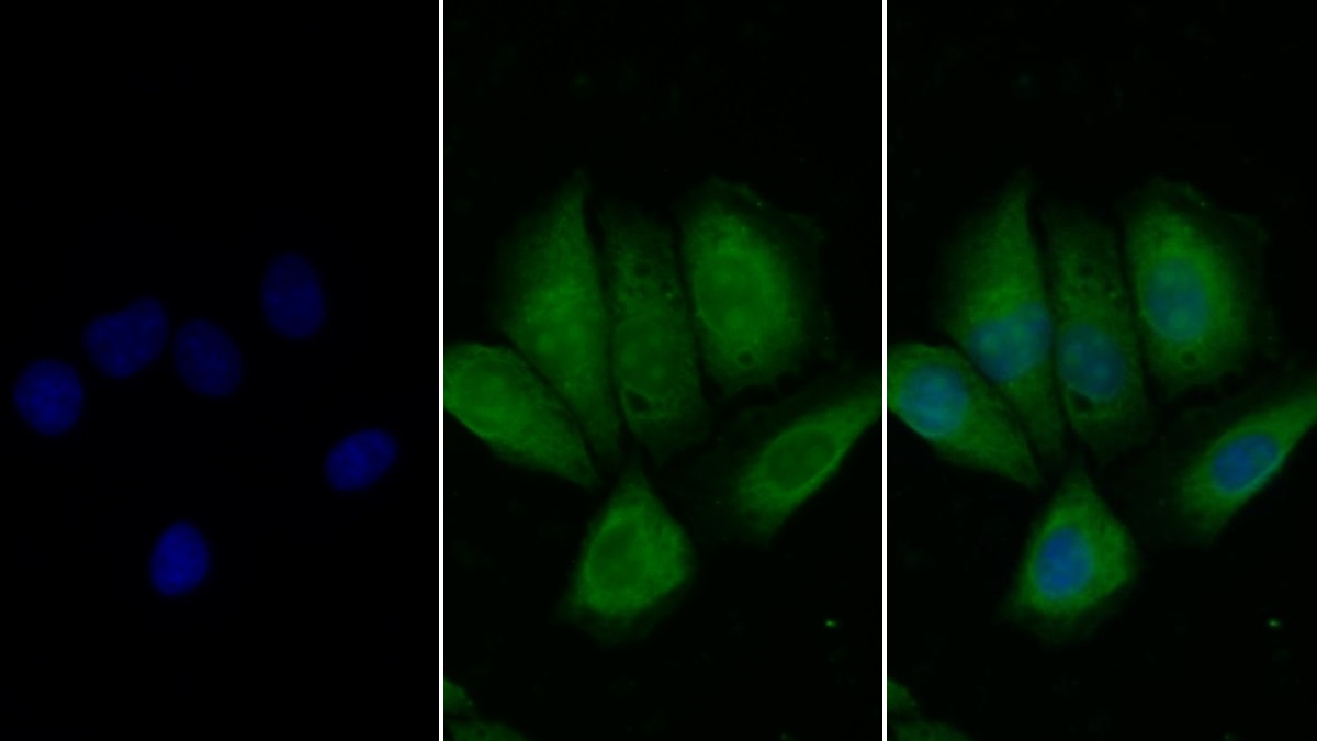 Monoclonal Antibody to S100 Calcium Binding Protein A6 (S100A6)