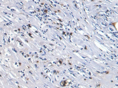 Monoclonal Antibody to S100 Calcium Binding Protein A8 (S100A8)