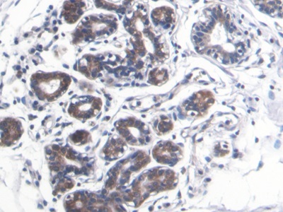 Monoclonal Antibody to S100 Calcium Binding Protein A8 (S100A8)