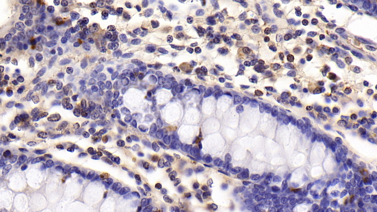 Monoclonal Antibody to Cluster Of Differentiation 5 (CD5)