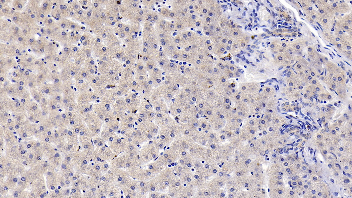 Monoclonal Antibody to Vitamin D Binding Protein (DBP)