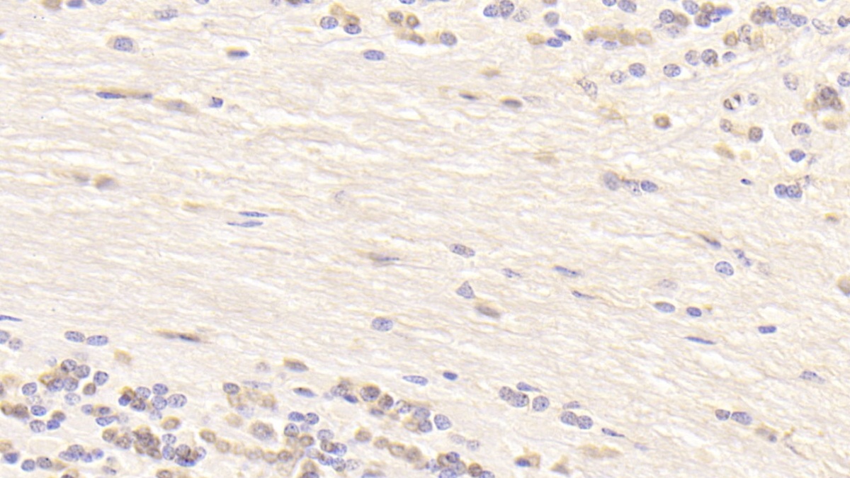 Monoclonal Antibody to Hedgehog Homolog, Sonic (SHH)