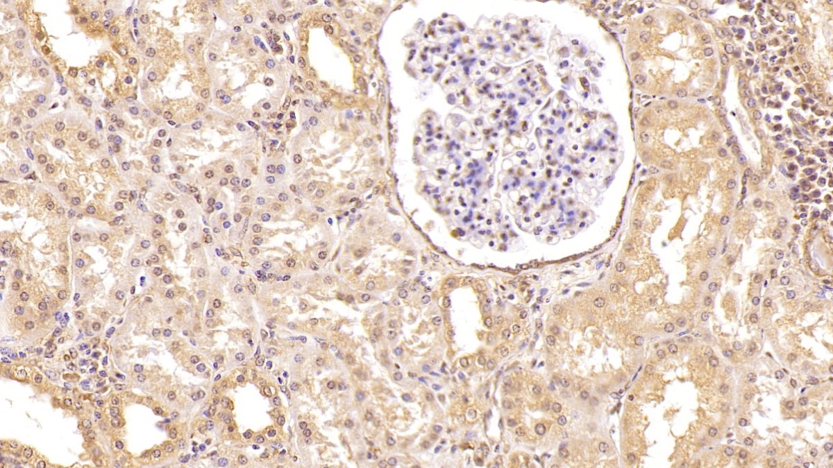 Monoclonal Antibody to Complement Factor D (CFD)