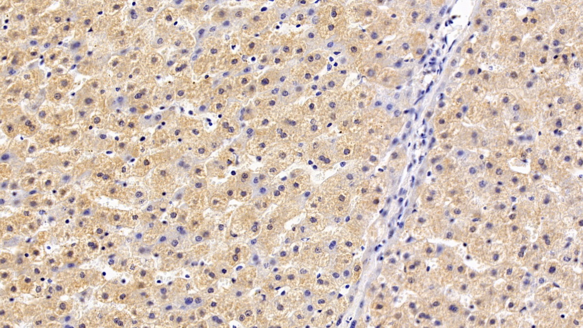 Monoclonal Antibody to Coagulation Factor XI (F11)