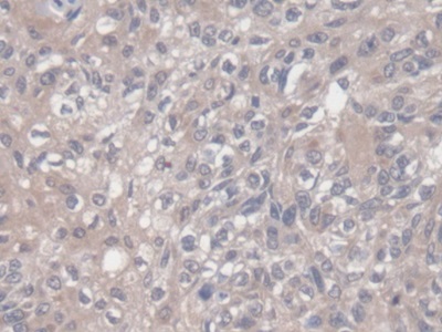 Monoclonal Antibody to Vascular Endothelial Growth Factor 121 (VEGF121)