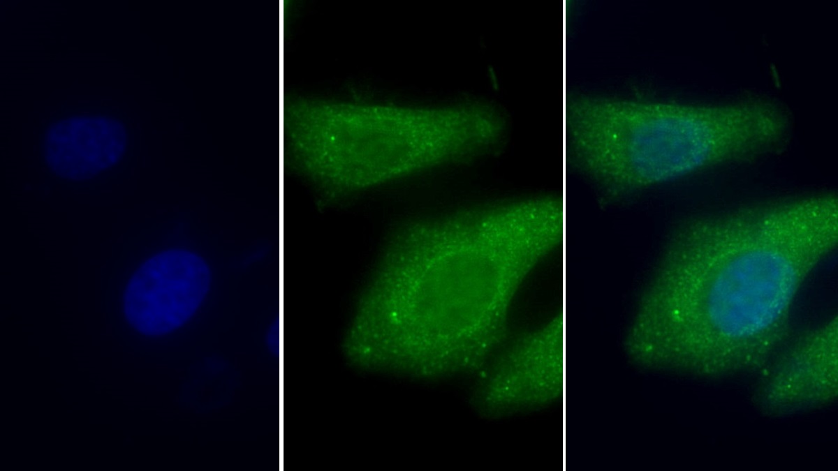 Monoclonal Antibody to Lectin Like Oxidized Low Density Lipoprotein Receptor 1 (LOX1)