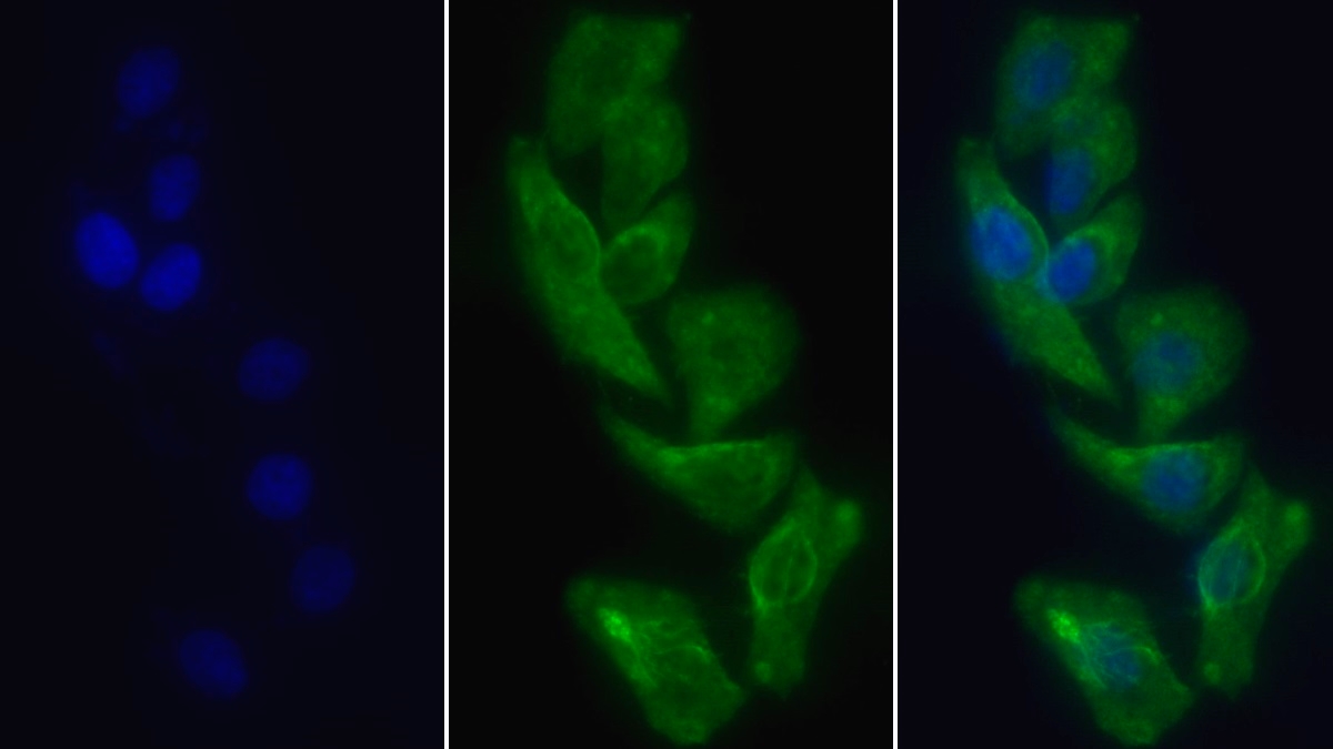 Monoclonal Antibody to Lectin Like Oxidized Low Density Lipoprotein Receptor 1 (LOX1)