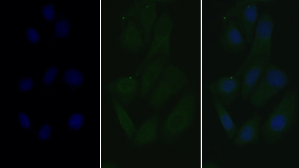 Monoclonal Antibody to Lectin Like Oxidized Low Density Lipoprotein Receptor 1 (LOX1)