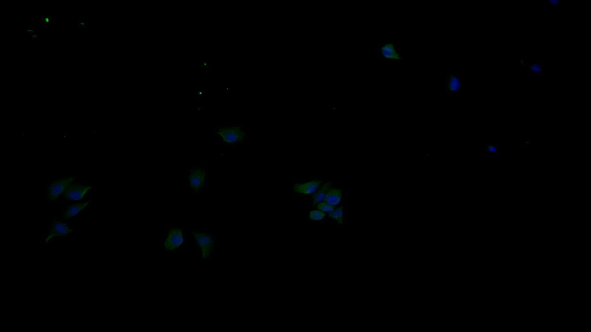 Monoclonal Antibody to Receptor Tyrosine Protein Kinase erbB-2 (ErbB2)