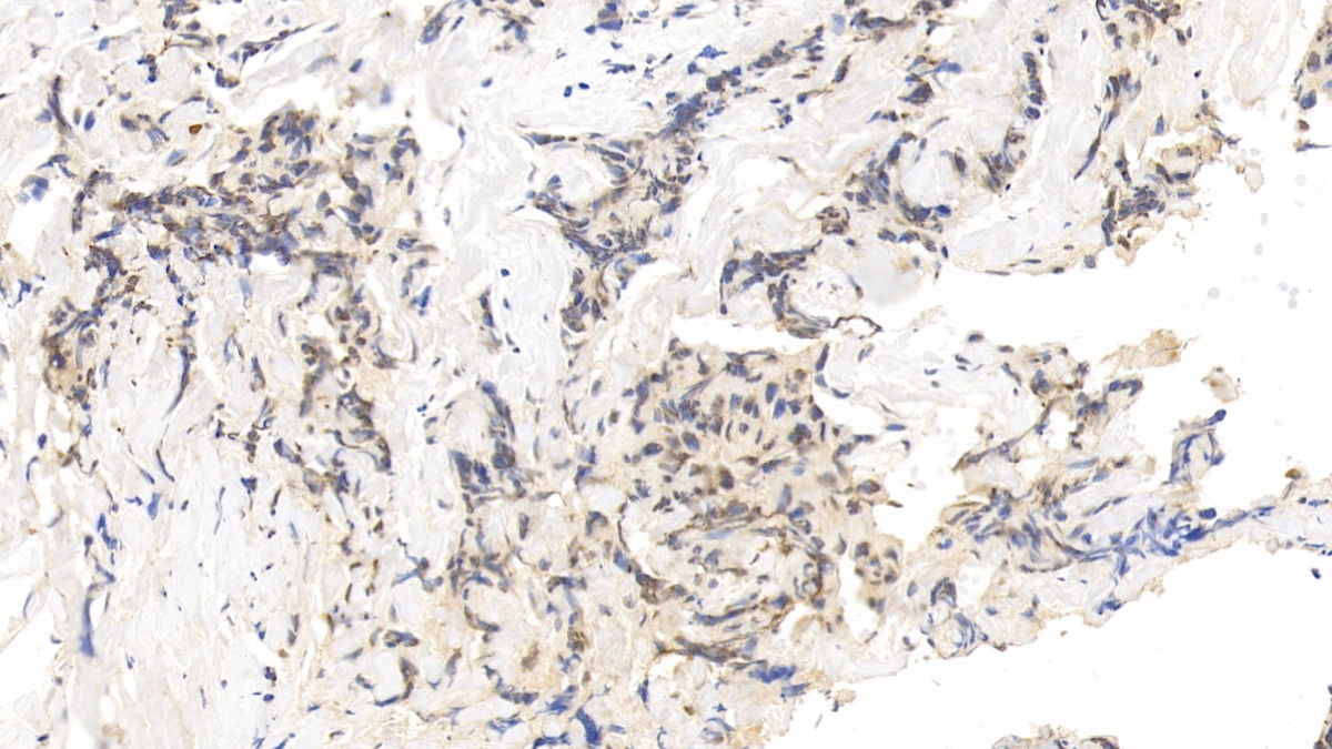 Monoclonal Antibody to Forkhead Box P3 (FOXP3)