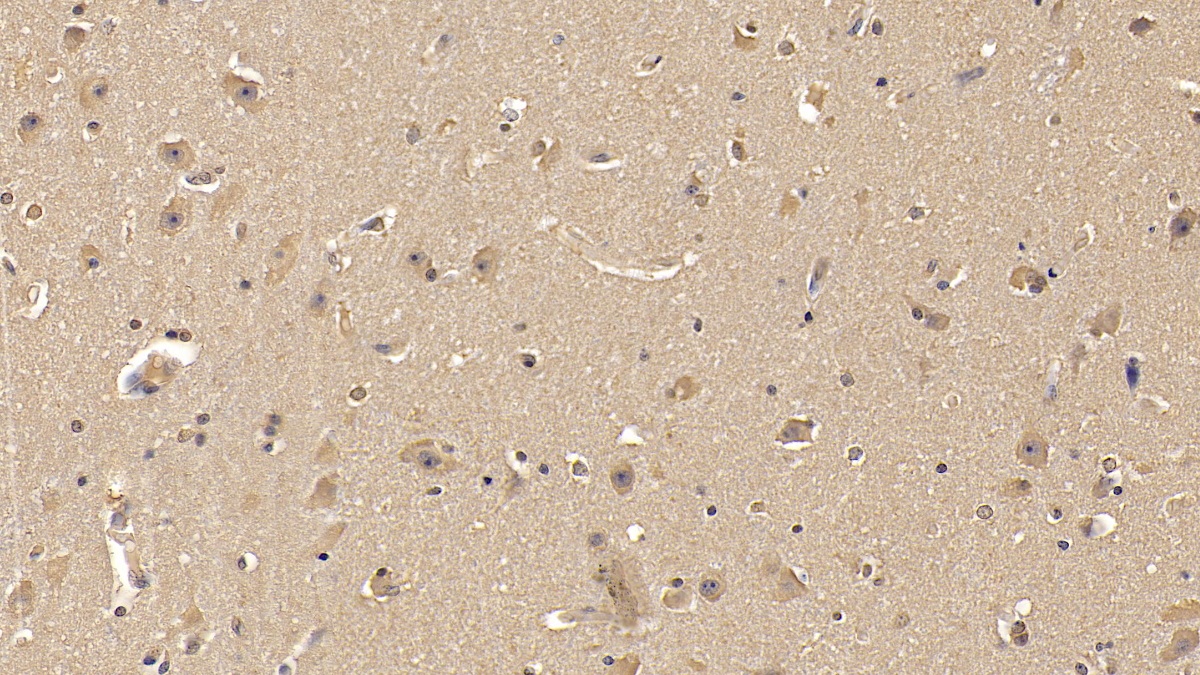 Monoclonal Antibody to Matrix Metalloproteinase 25 (MMP25)