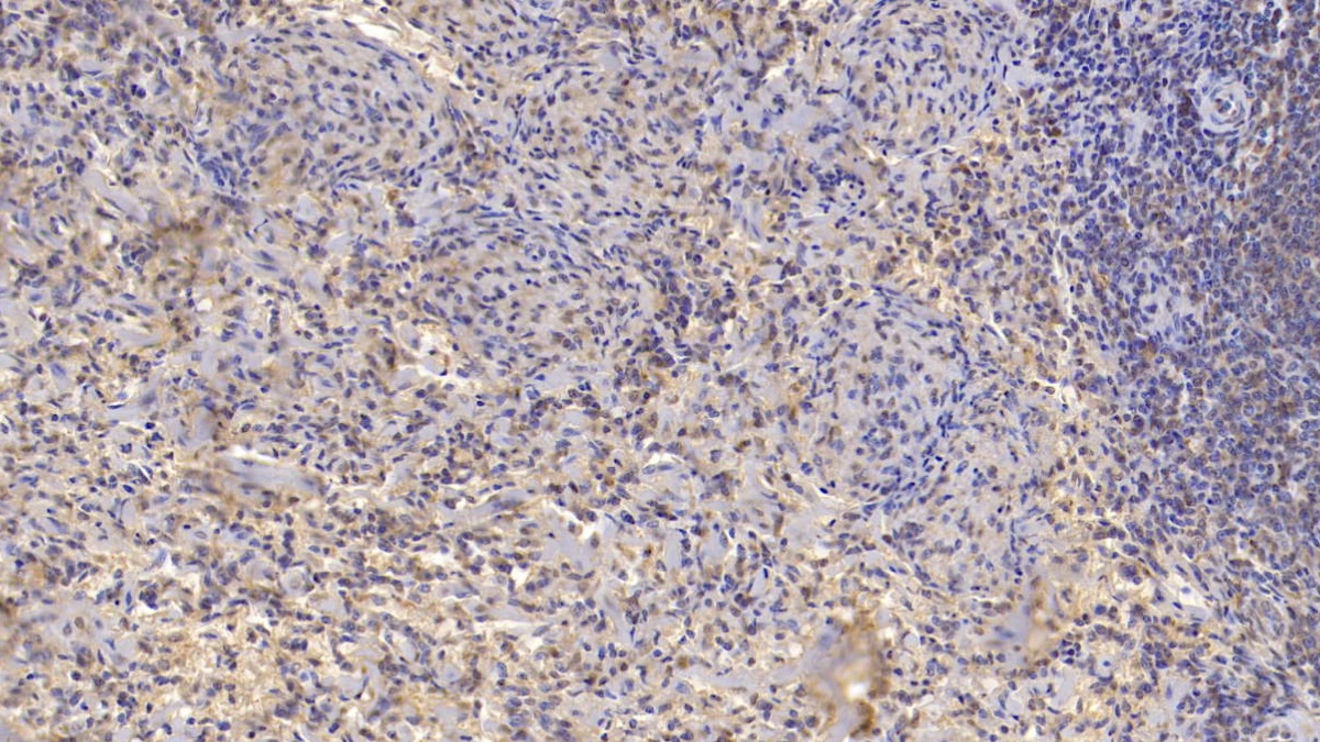 Monoclonal Antibody to Monokine Induced By Interferon Gamma (MIg)