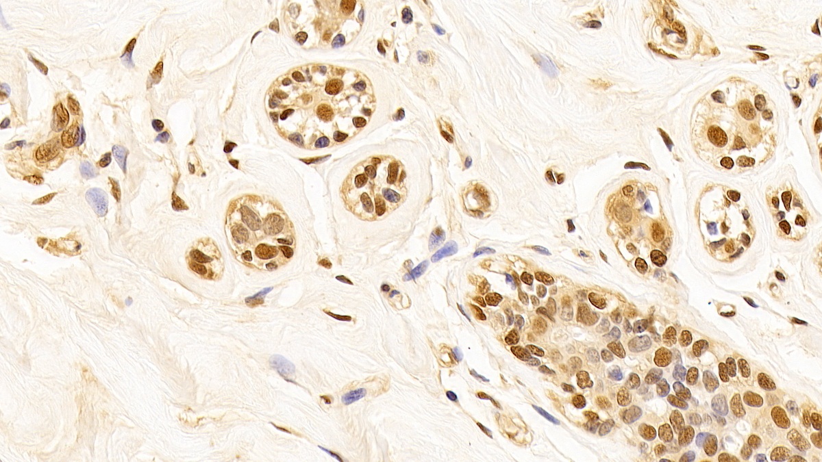 Monoclonal Antibody to Glyceraldehyde-3-Phosphate Dehydrogenase (GAPDH)