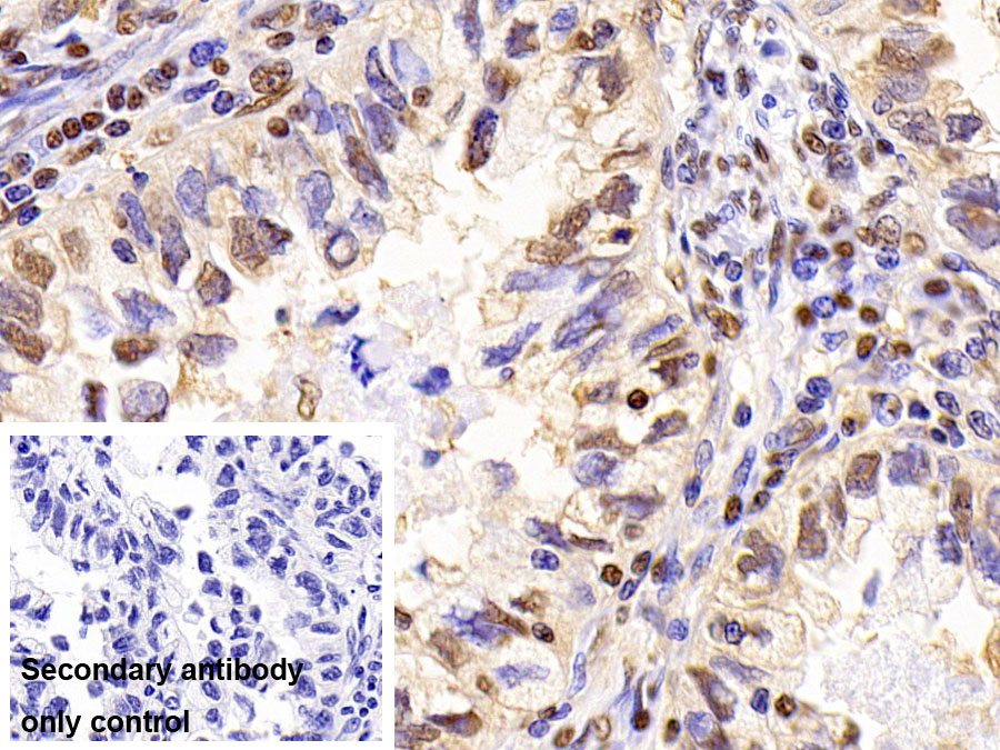 Monoclonal Antibody to Glyceraldehyde-3-Phosphate Dehydrogenase (GAPDH)