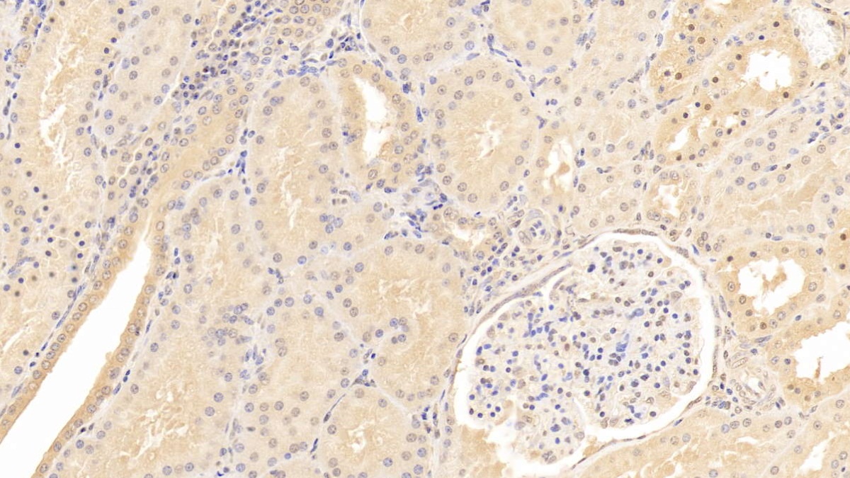 Monoclonal Antibody to Annexin A2 (ANXA2)