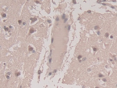 Monoclonal Antibody to Transforming Growth Factor Beta 3 (TGFb3)