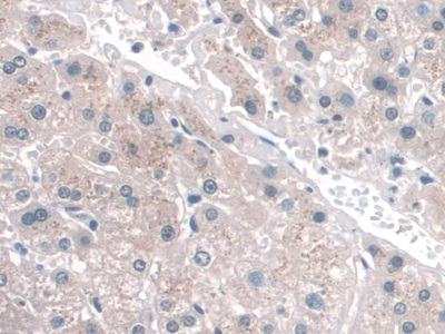 Monoclonal Antibody to Cluster Of Differentiation 34 (CD34)