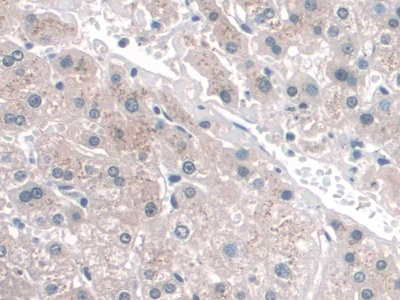 Monoclonal Antibody to Cluster Of Differentiation 34 (CD34)