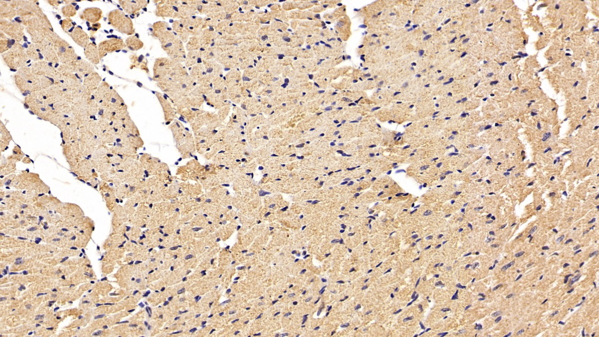 Monoclonal Antibody to Superoxide Dismutase 1 (SOD1)