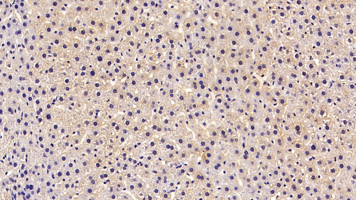 Monoclonal Antibody to Superoxide Dismutase 1 (SOD1)