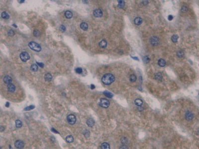 Monoclonal Antibody to Hepcidin (Hepc)