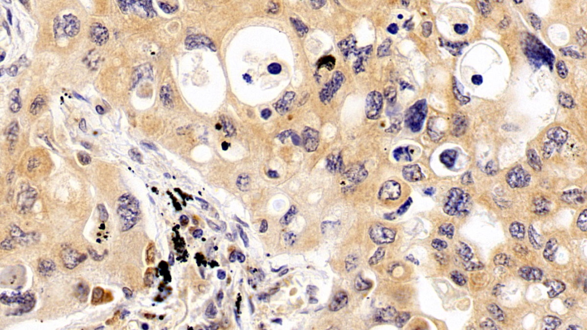 Monoclonal Antibody to Tau Protein (MAPT)