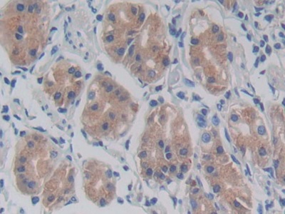 Monoclonal Antibody to Toll Like Receptor 5 (TLR5)