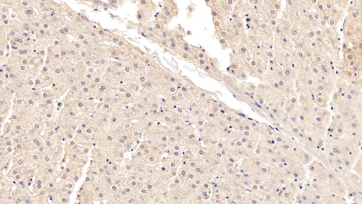 Monoclonal Antibody to Apolipoprotein B (APOB)