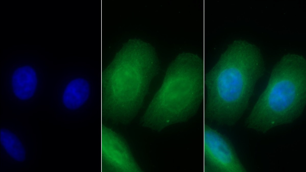 Monoclonal Antibody to Interleukin 8 Receptor Beta (IL8Rb)