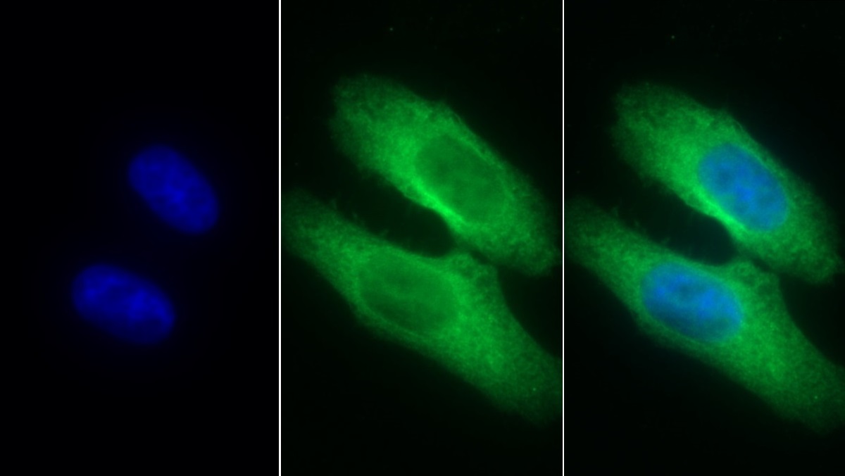 Monoclonal Antibody to Interleukin 8 Receptor Beta (IL8Rb)