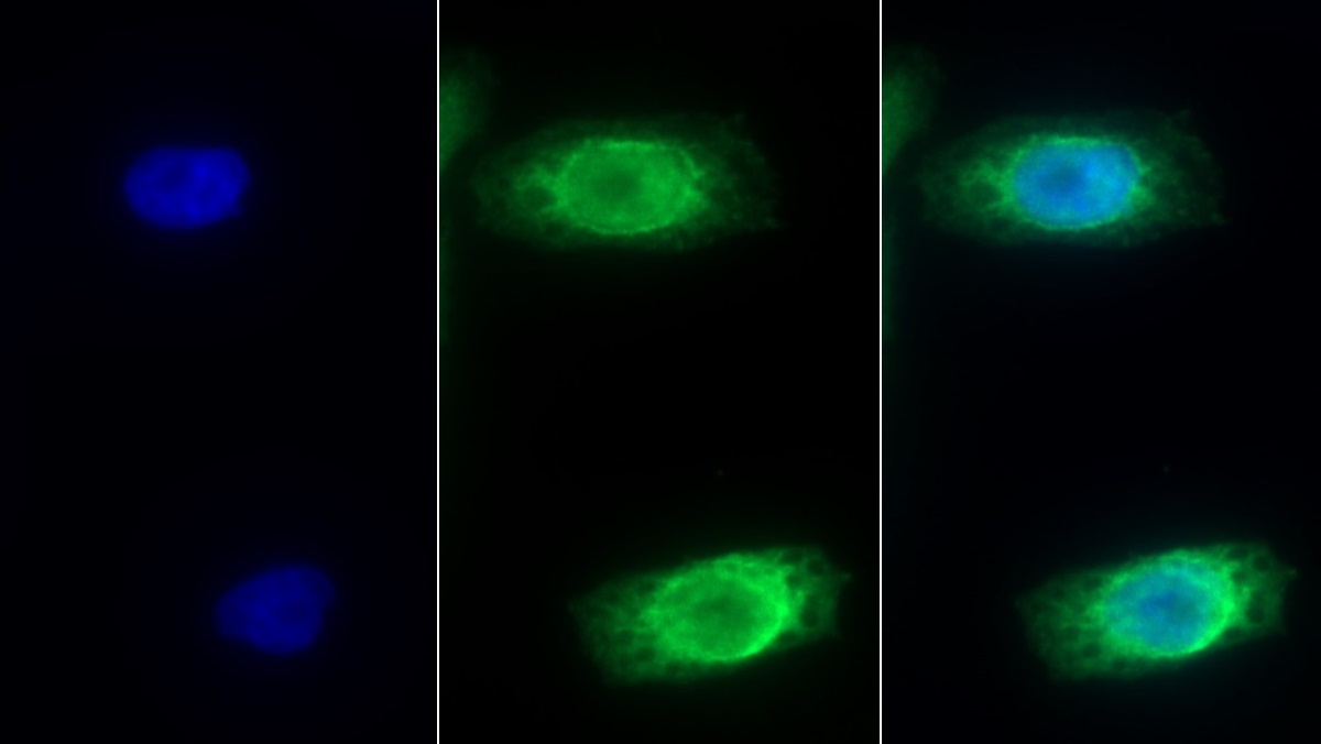 Monoclonal Antibody to Interleukin 8 Receptor Beta (IL8Rb)