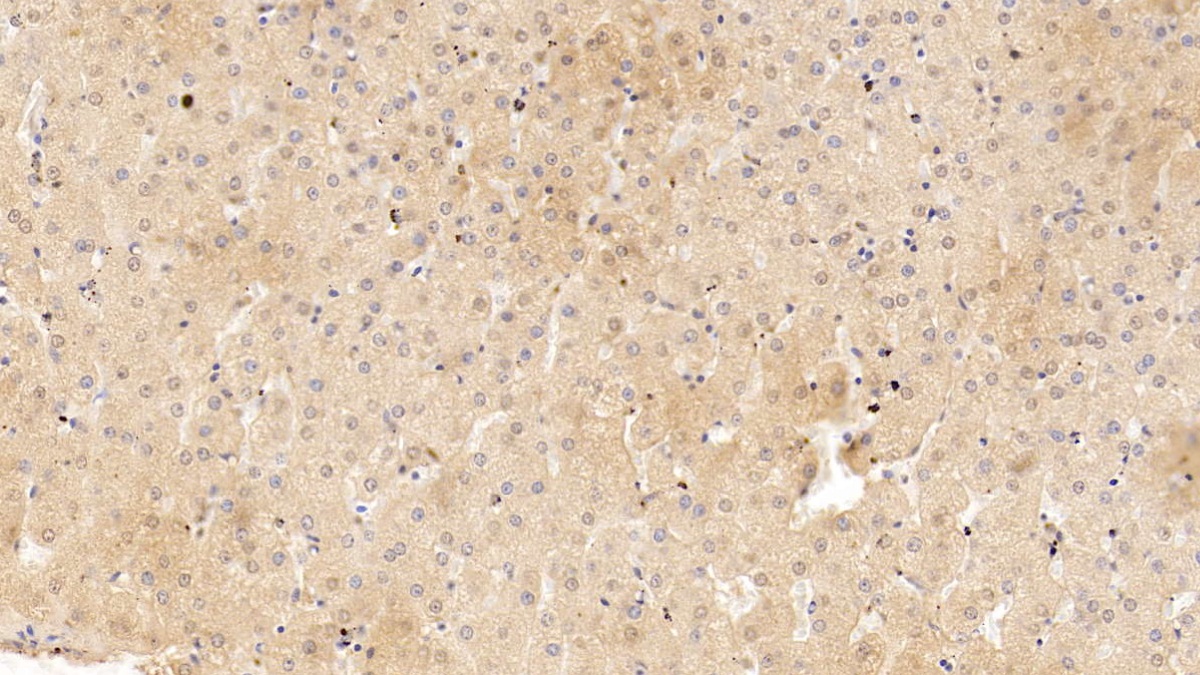 Monoclonal Antibody to Serpin A10 (SERPINA10)