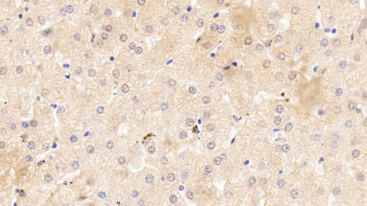 Monoclonal Antibody to Serpin A10 (SERPINA10)