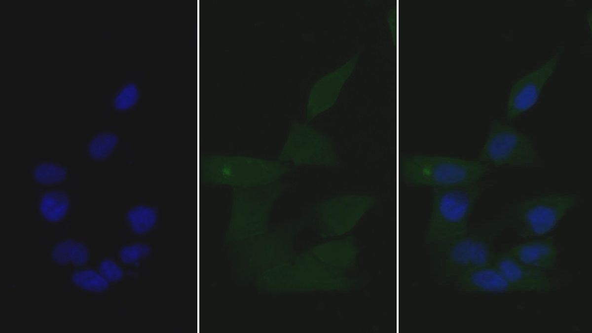 Monoclonal Antibody to Growth Differentiation Factor 15 (GDF15)