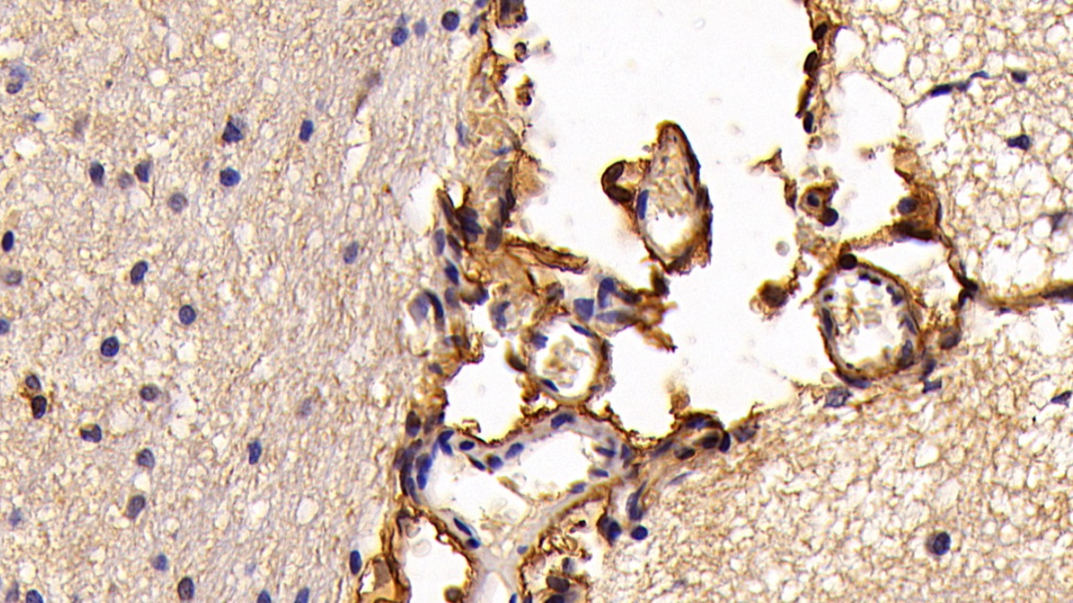 Monoclonal Antibody to S100 Calcium Binding Protein A10 (S100A10)