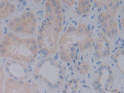 Monoclonal Antibody to Bone Morphogenetic Protein 10 (BMP10)