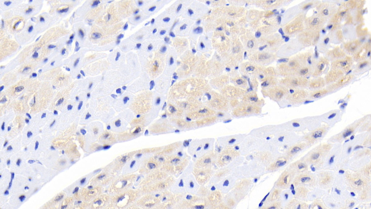 Monoclonal Antibody to Activin A Receptor Type II A (ACVR2A)