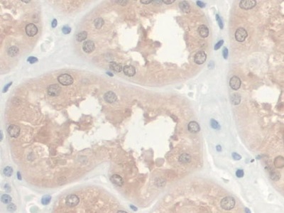 Monoclonal Antibody to Gremlin 1 (GREM1)