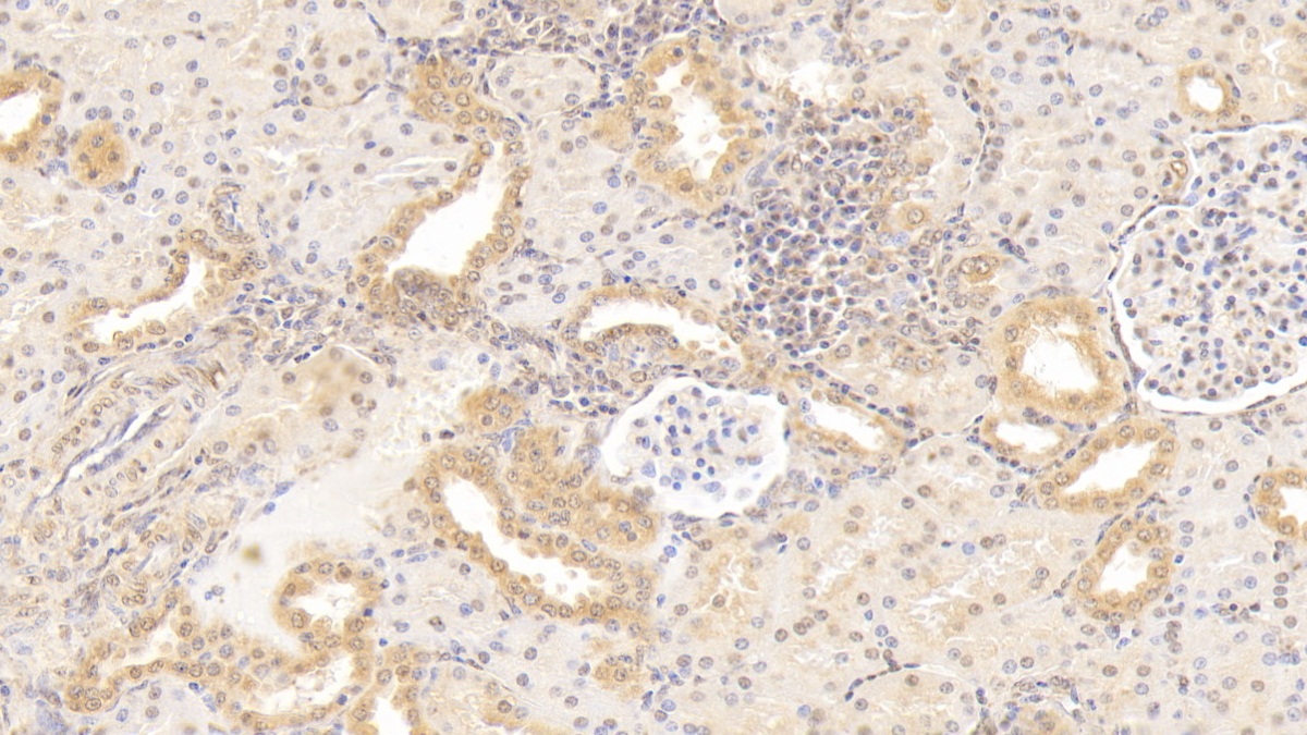 Monoclonal Antibody to Gremlin 1 (GREM1)