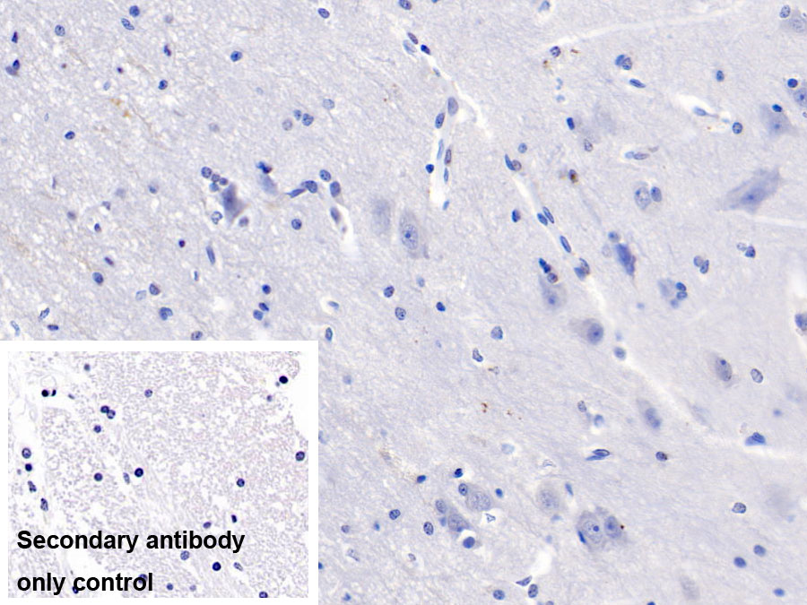 Monoclonal Antibody to Collagen Type V Alpha 2 (COL5a2)