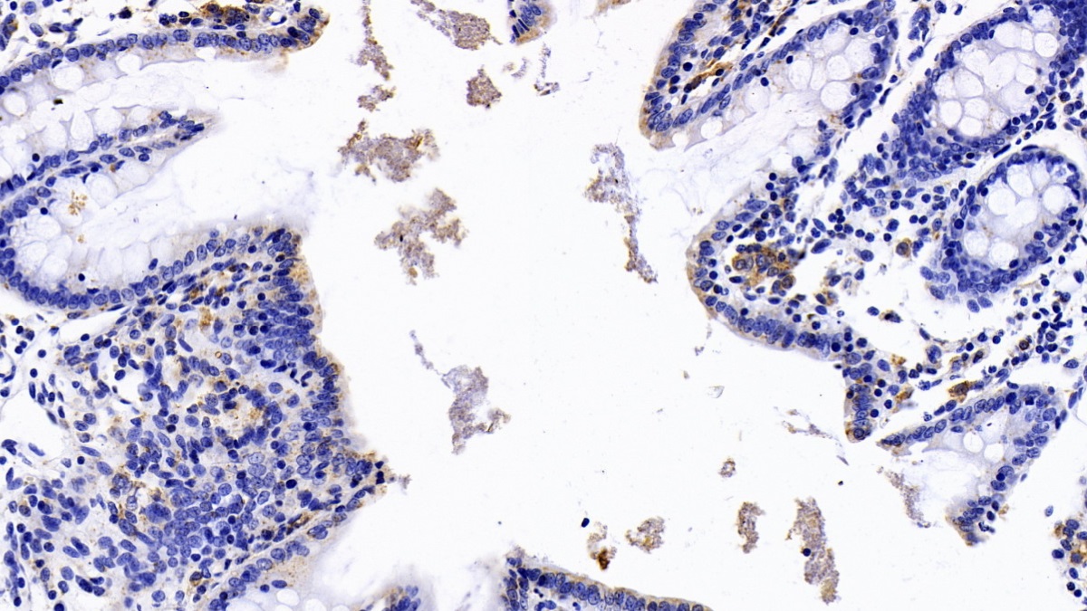 Monoclonal Antibody to HLA Class II Histocompatibility Antigen, DRB1 Beta Chain (HLA-DRB1)