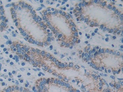 Monoclonal Antibody to Anterior Gradient 2 (AGR2)