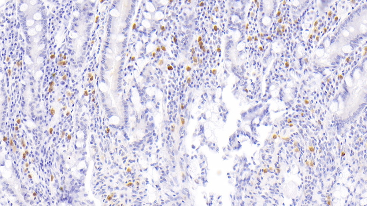 Monoclonal Antibody to Allograft inflammatory factor 1 (AIF1)