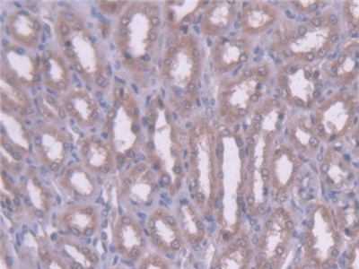 Monoclonal Antibody to Angiotensin III (AngIII)