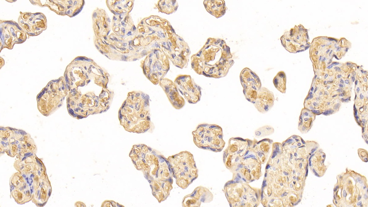 Monoclonal Antibody to Antithrombin (AT)