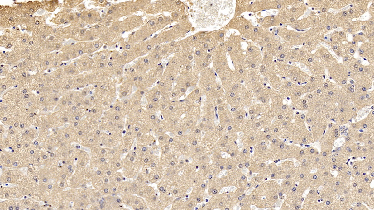 Monoclonal Antibody to Antithrombin (AT)