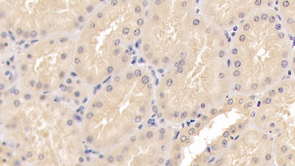 Monoclonal Antibody to Antithrombin (AT)