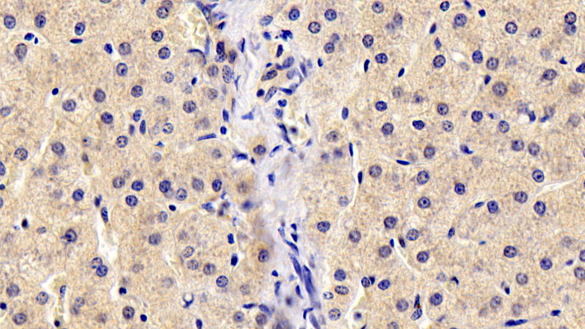 Monoclonal Antibody to Antithrombin (AT)