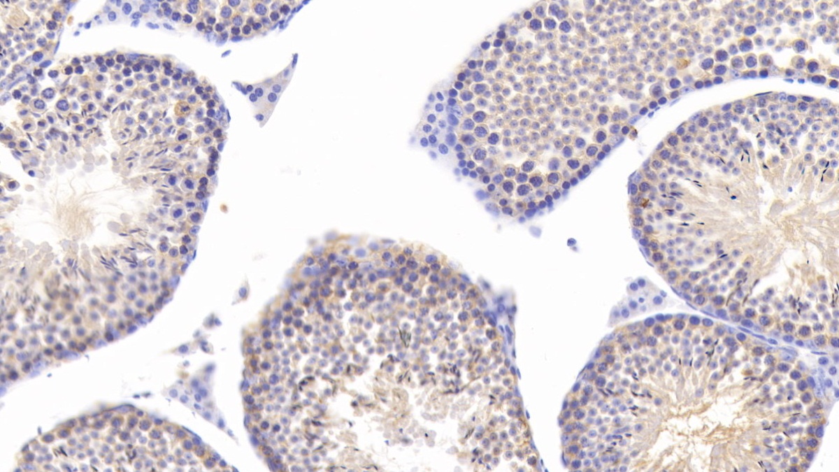 Monoclonal Antibody to Heat Shock 70kDa Protein 5 (HSPA5)