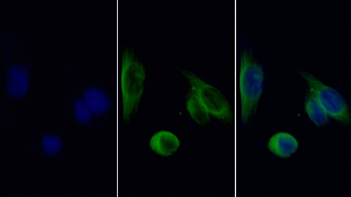 Monoclonal Antibody to Heat Shock 70kDa Protein 5 (HSPA5)